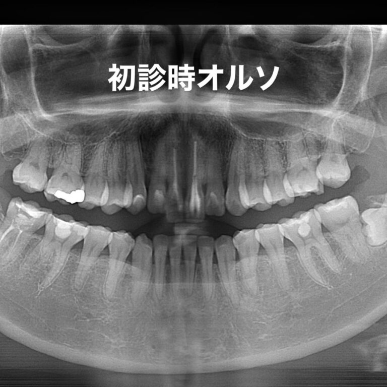 審美歯科