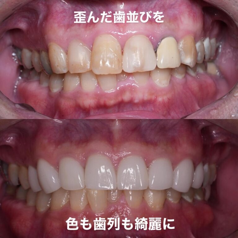 審美歯科