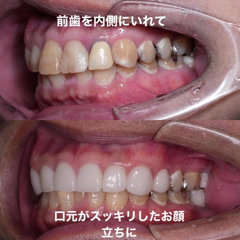 審美歯科