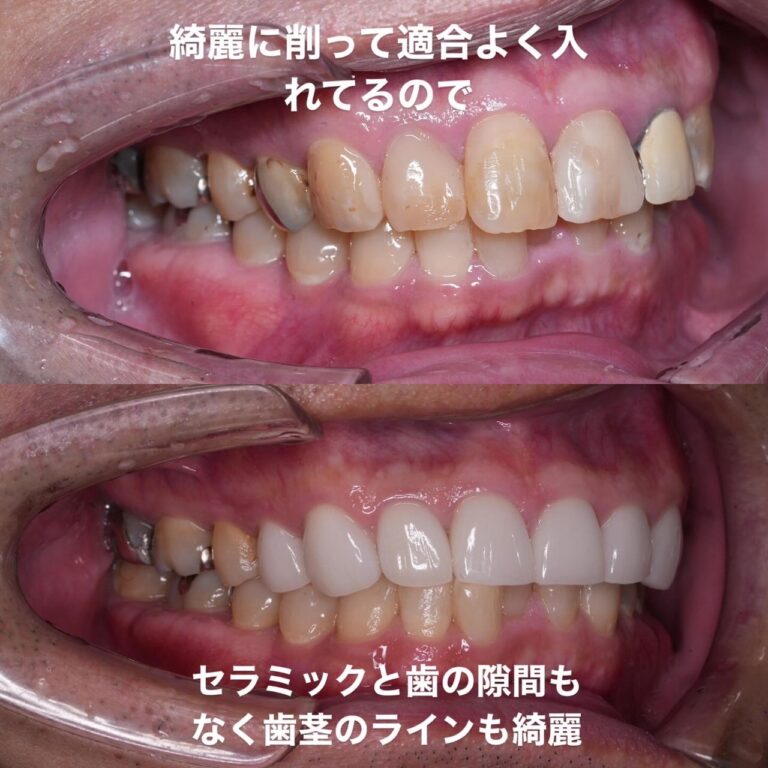 審美歯科