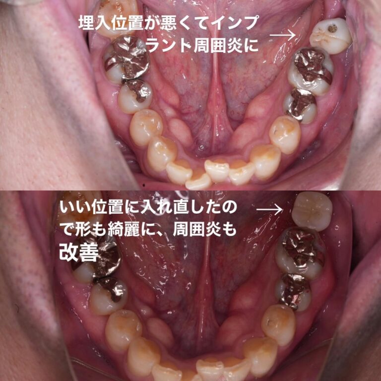 審美歯科